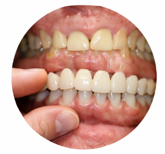 Reabilitação Protética